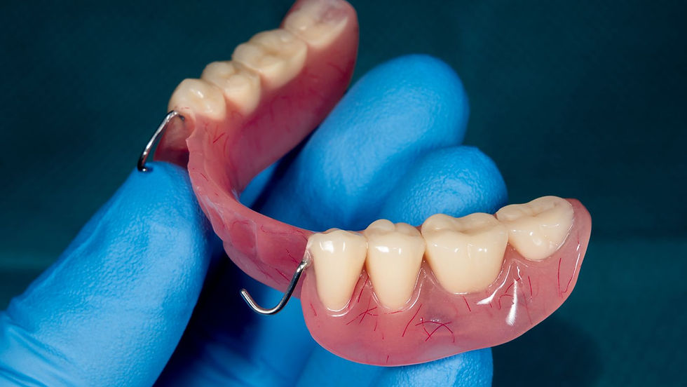 Wie Lange Dauert Eine Reparatur Einer Zahnprothese www.zahntechniker.wien